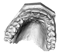 modello 3d denti
